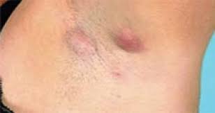 Koltuk Altinda Ciban