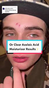 Replying to @khloe_wierd I feel like it definitely helped😳What do y’all  think🤔 #results #orclear #acne #acnetreatment #clearskin @dirkwalker912