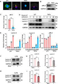 Nanotube patterning reduces macrophage inflammatory response via nuclear  mechanotransduction