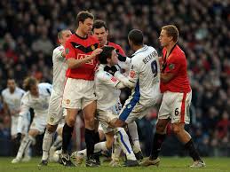 Leeds united matchup from every angle, and he is leaning over the total (2.5 goals). Man Utd V Leeds On Tv Off 67