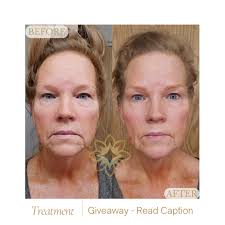 The first person to guess what service gave these INCREDIBLE results will  get a FREE one. There are only two rules… Comment your answers below & tag  a friend!!!! *Winner Selected* Results