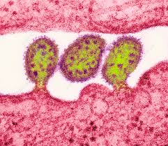 Image result for Lassa Fever