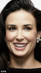 Party's over for Botox: Patients must be vetted by doctors before having  'beauty' jabs