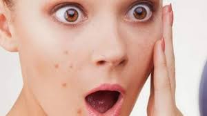 Beberapa produk skincare jerawat seperti serum dan toner mengandung bahan utama glycolic acid atau asam glikolat. Tips Cantik Hari Ini Tips Menghilangkan Jerawat Dengan Lima Produk Drugstore Yang Mudah Dicari Tribun Jatim