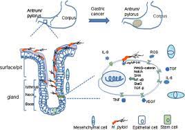 Helicobacter Pylori Infection Stem Cells And Gastric Cancer H Pylori Download Scientific Diagram