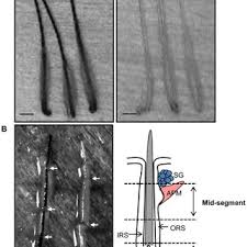 Less catalase is produced as we age resulting in the accumulation of hydrogen peroxide. Catalase Enzyme Activity In Hair Follicles Estimated By Download Scientific Diagram