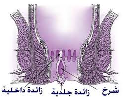 الشرخ الشرجى و الام الشرج و مابعد د محمد صيرة للجراحة العامة و المناظير و جراحات القولون و الشرج Facebook