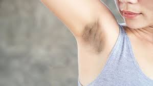 Bagaimana cara mencukur ketiak hitam? 5 Penyebab Ketiak Jadi Hitam