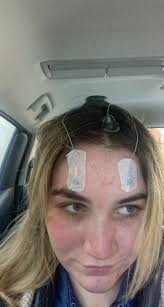 Hey wanted to introduce myself im stuart i was diagnosed with epilepsy when  I was 16 then about 3 years ago non epileptic attack disorder the attacks  present with full body convulsions.