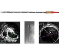 Philips Volcano - Visions PV .035 Catéter digital de IVUS