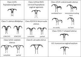 We did not find results for: Diagnosis And Treatment Of Mullerian Malformations Sciencedirect