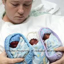 This week's #umichpath #CaseOfTheWeek: A 24-year-old female, pregnant at 37  weeks with her first child, presented to the emergency room with high  fevers and chills after her water broke at home hours