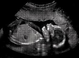 Bisexual = falling in love with both genders. Earliest You Can Tell Baby Gender 5 Ways To Predict