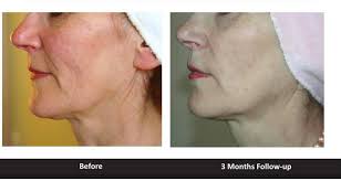 Noh (jalan tar) klinik pakar kulit md. Lagenda Medical Clinic Home Facebook