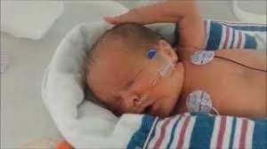 Babies who have breathing difficulties will. Hendrix And Harper Born At 32 Weeks Nicu Journey Of Two Twin Boys Youtube