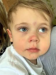 Toddler's tonsillitis left him 'violent and possessed' after triggering  rare illness