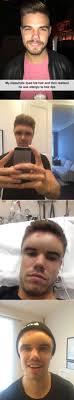 My Classmate Dyed His Hair And Then Realized He Was Allergic To Hair Dye Stupid Funny Memes Have A Laugh Stupid Funny