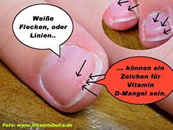 Auch das immunsystem braucht eine gewisse menge an vitamin a. Orthopadische Gemeinschaftspraxis Unser Spektrum Vitamin D Mangel