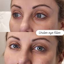 Injections By Sabina added a new...