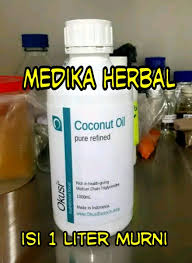 Karena mereka berasal dari keluarga yang berkecukupan sehingga mereka tidak takut untuk nikah muda. 7 Manfaat Menakjubkan Air Kelapa Untuk Ibu Hamil Bukareview