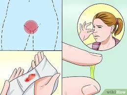 Itching can wake you up in the middle of the night. How To Stop Vaginal Itching With Pictures Wikihow