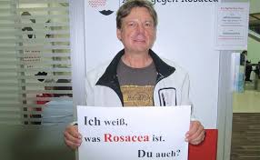 Das rhinophym ist eine benigne dermatologische erkrankung der äußeren nase, die in erster linie bei kaukasiern ab dem 50.lebensjahr auftritt. Rhinophym Psychische Belastung Durch Rosacea