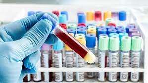 Difficile à diagnostiquer, cette maladie est souvent prise en charge à un stade déjà bien a noter : Un Test Sanguin Pour Depister Plus Tot Le Cancer Du Pancreas