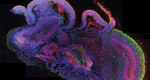 National geographic stories take you on a journey that's always enlightening, often surprising, and unfailingly fascinating. Tiny Human Almost Brains Made In Lab Science News