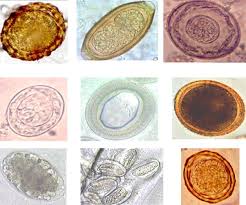 parasitic worm wikipedia