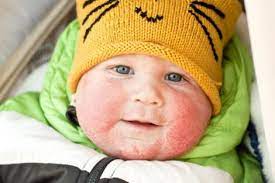 Sintomas Del Mal De Ojo En Bebes Y Recien Nacidos Y Como Protegerles