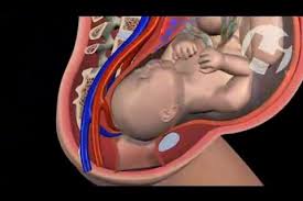 Image result for Amniotomy