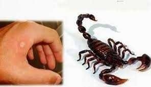 Scorpion print scorpion vector scorpion isolated fish astrology star astrology gemini astorogy scorpion photo zodiac sign wheel star lion zodiac circle vector. Take These Medicines When Scorpion Stings Only Then Will The Sting Itself Out Steemkr