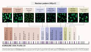Image result for ANA Staining Pattern