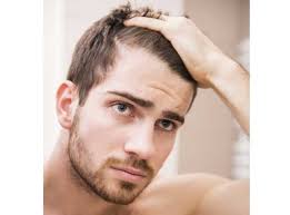Thinning hair and hair loss in younger men is usually a result of androgenetic alopecia, but it can also be brought on by poor nutrition and stress. Hair Loss At 30 Male Promotion Off66