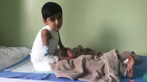 Saman, rewa, a village in rewa district in madhya pradesh, india. Dramatische Flucht Die Odyssee Des Kleinen Saman Br24 Br De