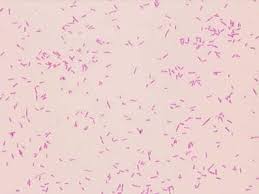 Image result for yersinia fotos