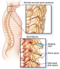 These muscles lie on each side of the vertebral column﻿, deep to the thoracolumbar fascia﻿. Upper Back Pain Middle Shoulder Pain Causes Treatment