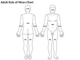 rule of 9s for burns chart rule off nines