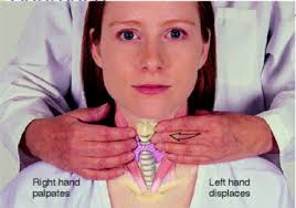 Dar daca eu in 14 aug merg la casa de. Suspendarea Cim Se Transmite In Revisal