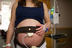 Image result for Contraction Stress Test