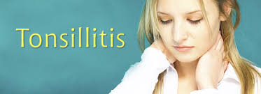 Image result for tonsillitis