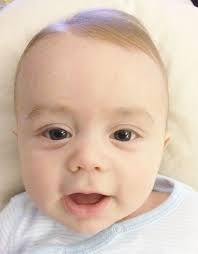 Coconut oil, apart from being an antioxidant, is also fortified with properties that enable it to combat microorganisms and fungus. 11 Best Baby Eczema Ideas Baby Eczema Eczema Eczema Treatment