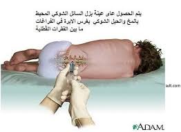 الهيئة العامة لمشفى دمشق التصلب اللويحي المتعدد
