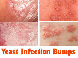 Pin On Herbal Home Remedies