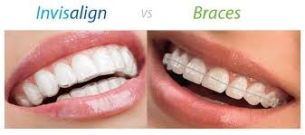 Pin On Dentistry