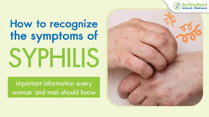 Image result for syphilis symptoms
