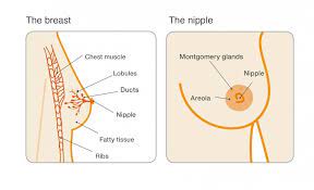 Similar to other cancer, patients can be symptomatic or asymptomatic. Duct Ectasia Breast Cancer Now