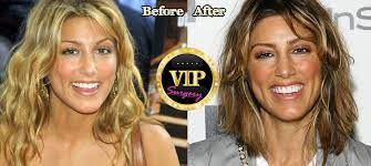 By staryes · april 26, 2017. Hollywood Plastic Surgery Nightmare Jennifer Esposito Appearance Disaster