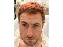 Concord Police Say Healy Park Incident Was A Shooting: Follow-Up