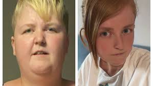 Fundraiser by Hannah Sleight : Raising money to help pay for my surgery